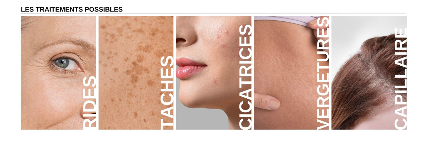 Formation Microneedling en Ligne (TROUSSE et APPAREIL INCLUS et livrés lors de l'inscription)